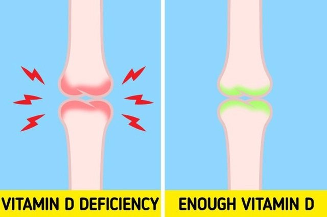6 dấu hiệu cảnh báo cơ thể thiếu vitamin D, cần làm ngay 5 việc để bổ sung-4
