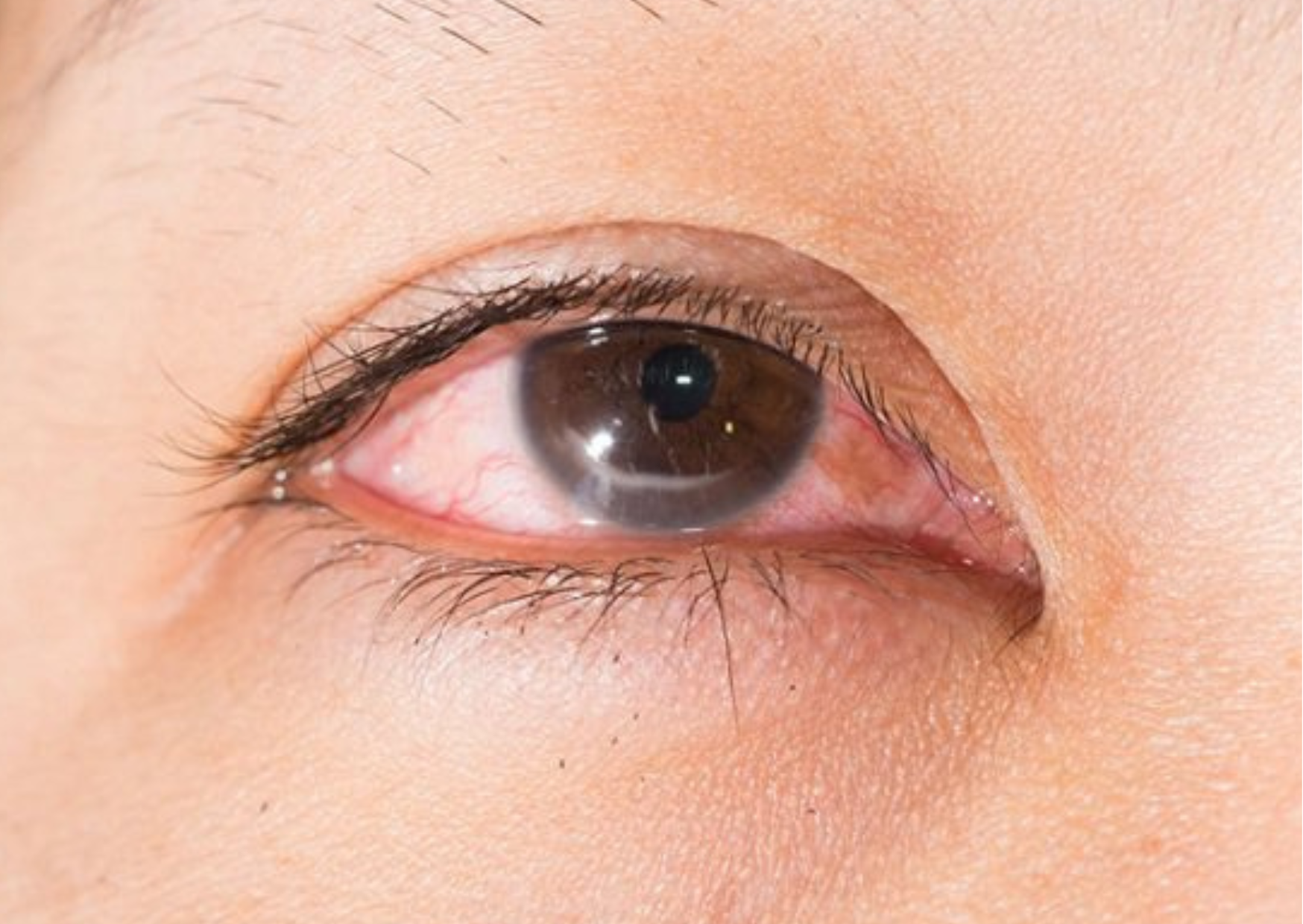 Gạc lau mi mắt Ocuvane Plus - sản phẩm chuyên dụng cho người bị viêm bờ mi, khô mắt-1