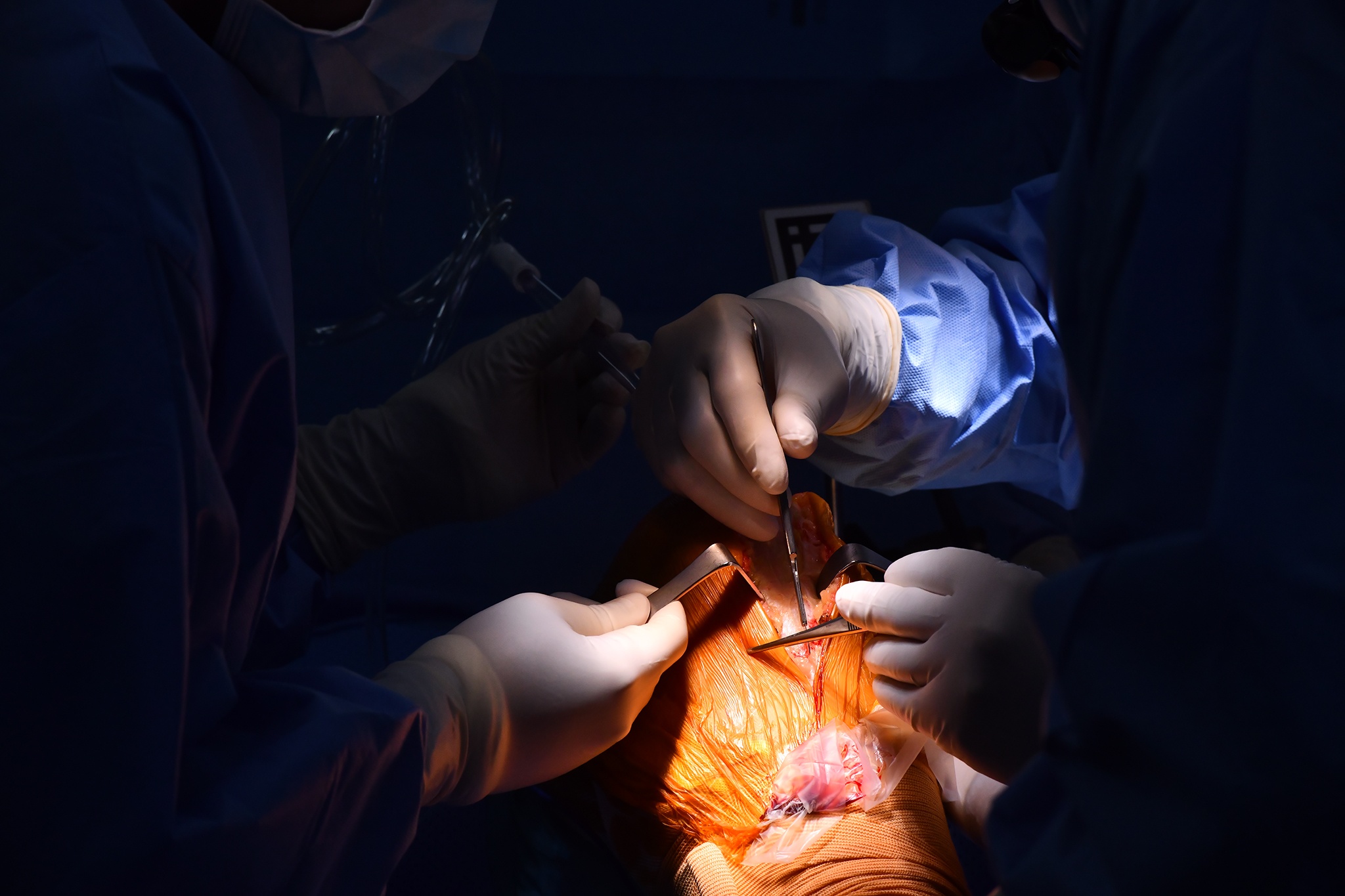 Ứng dụng công nghệ thực tế ảo trong phẫu thuật thay khớp gối-18