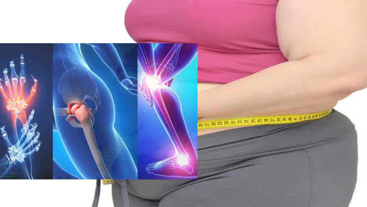 Thừa cân béo phì và tác hại khiến ai nấy cũng phải “giật mình”-2