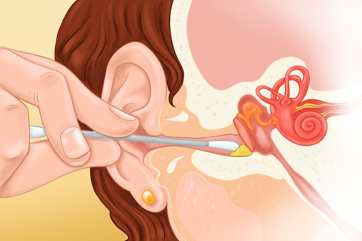 Đây là những lý do mà bạn nên ngừng ngay việc dùng tăm bông để vệ sinh tai và nhưng phương pháp khác để thay thế cho việc này-1