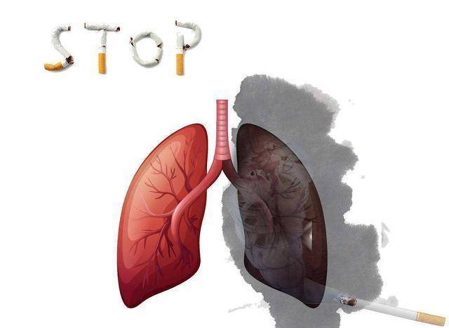 Có vấn đề với phổi, 2 dấu hiệu cổ họng giúp "tiên tri"-1