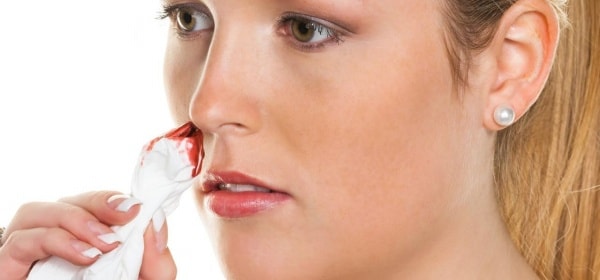 Sơ cứu chảy máu mũi đúng cách từ chuyên gia tai mũi họng-1