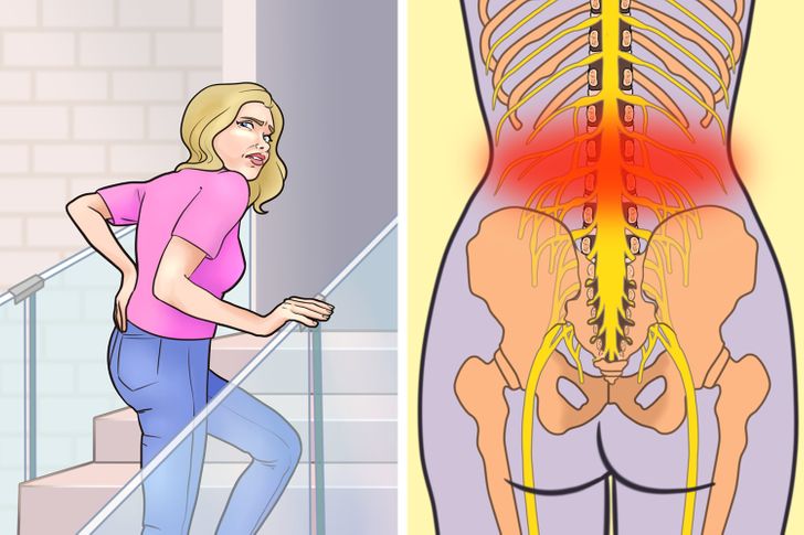 Những nhân tố không ngờ gây đau lưng dưới và để lại biến chứng dữ dội mà bạn vẫn vô tình làm hàng ngày-6