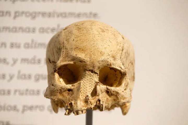 18.000 chiếc sọ người ở bảo tàng Pháp thuộc về ai?-1