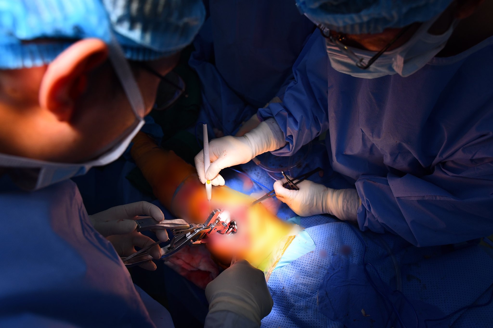 Ứng dụng công nghệ thực tế ảo trong phẫu thuật thay khớp gối-14