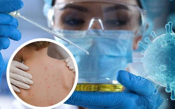 Bộ Y tế: Hàng năm Việt Nam ghi nhận từ 600.000 - 1 triệu trường hợp mắc cúm mùa-4