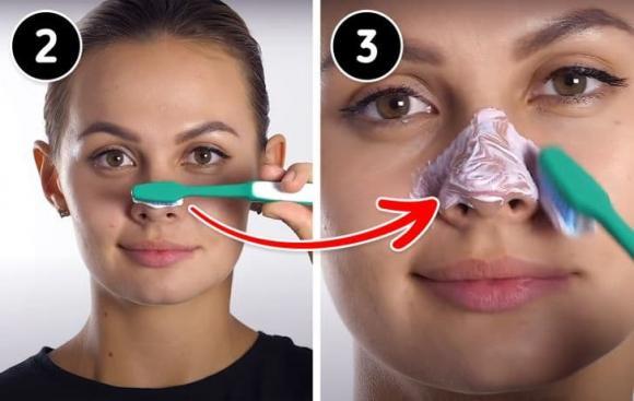 4 cách để loại bỏ mụn đầu đen trên mũi của bạn-2