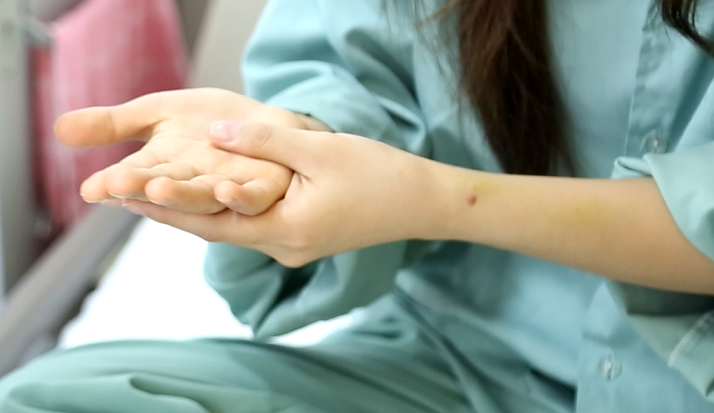Mồ hôi tay chảy thành dòng – điều trị đơn giản, hiệu quả ngay tại BVĐK tỉnh Phú Thọ-2