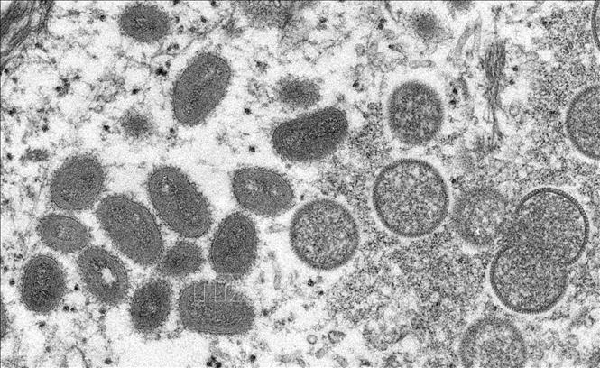 Argentina xác nhận ca tử vong đầu tiên vì bệnh đậu mùa khỉ-1