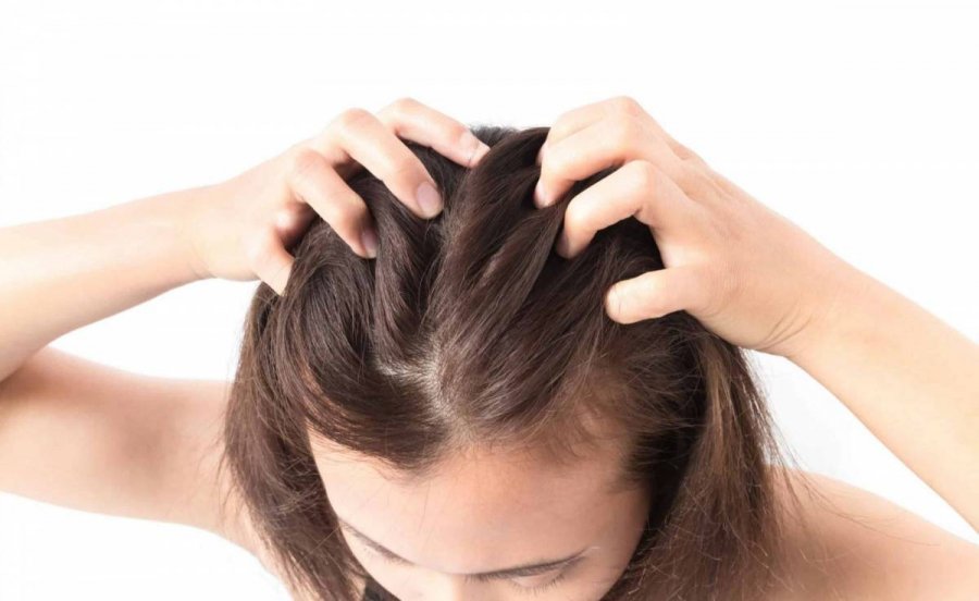 Chỉ với 4 cách massage đơn giản có thể thực hiện tại nhà sẽ ngăn ngừa rụng tóc, kích thích tóc mọc nhanh-1
