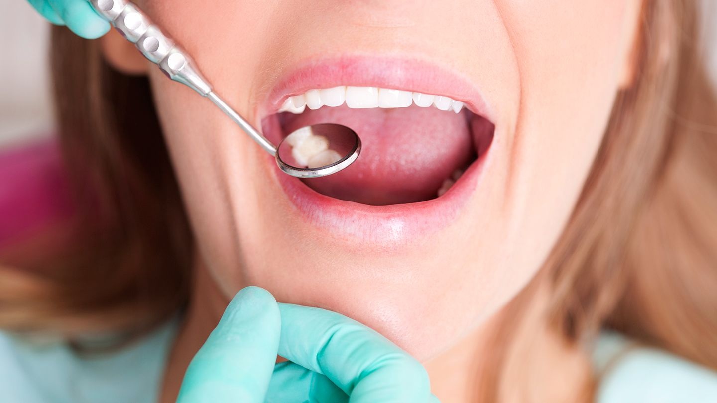 8 căn bệnh nha sĩ có thể phát hiện khi khám răng-1