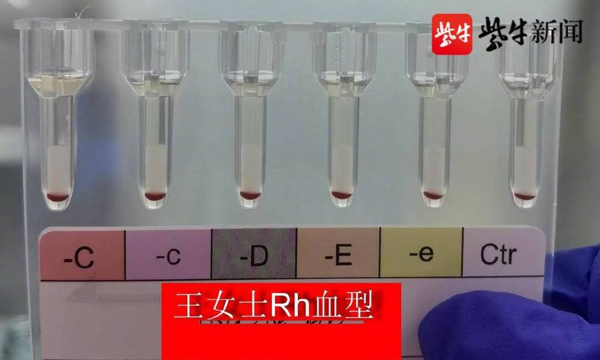 Trung Quốc phát hiện 2 phụ nữ có nhóm máu hiếm nhất thế giới-1