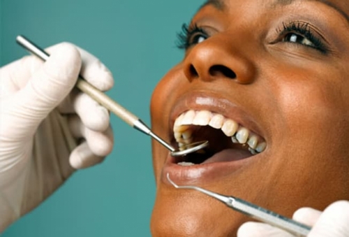 Điều gì khiến răng của bạn ngày càng trở nên vô cùng nhạy cảm-8