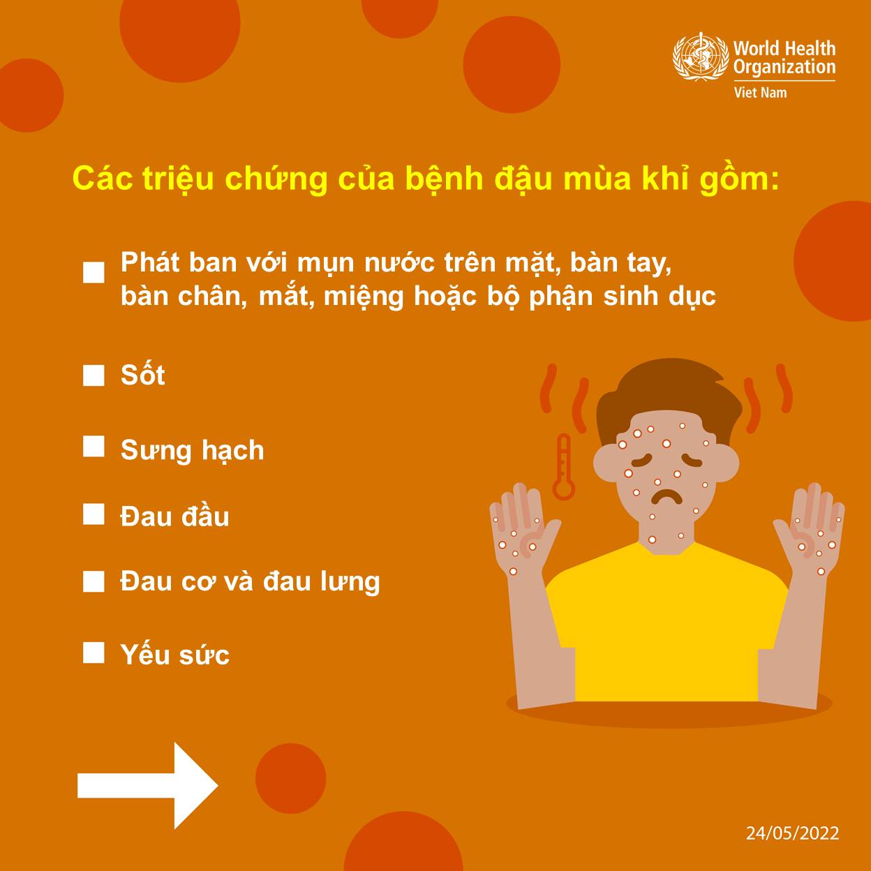 [Infographic] - Những điều cần biết về bệnh đậu mùa khỉ-3