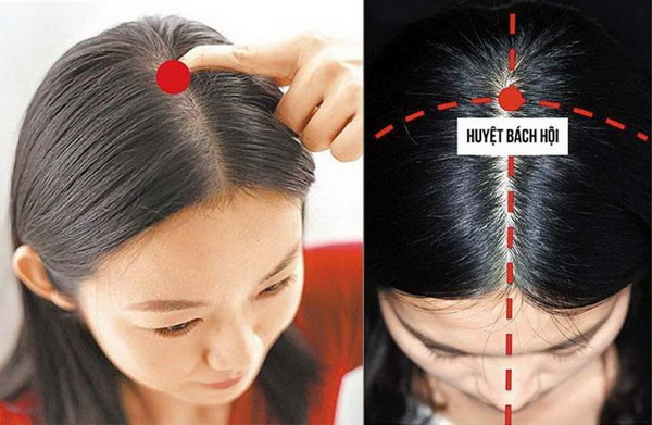 Chuyên gia Đông y chỉ cách bấm huyệt chữa đau đầu, không cần dùng thuốc mà vẫn hiệu quả-1
