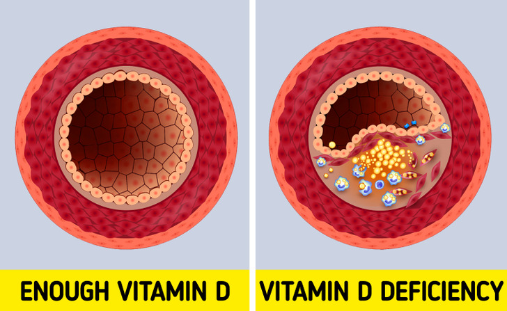 Cơ thể bị hủy hoại, sức khỏe bị đe dọa nghiêm trọng đến thế này nếu bạn đang thiếu Vitamin D-3