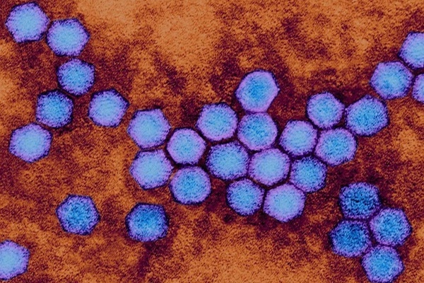 Virus bị xóa sổ gần 50 năm trước bất ngờ 'tái xuất' ở Anh-2