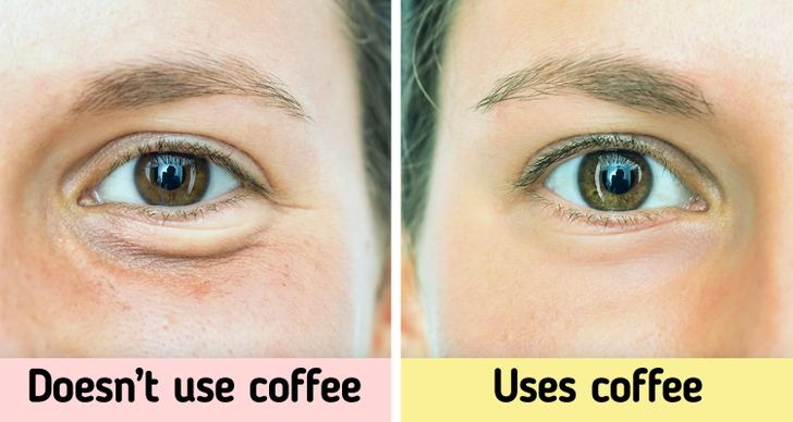 8 mẹo giúp bạn xóa tan quầng thâm và sự mệt mỏi cho đôi mắt-1