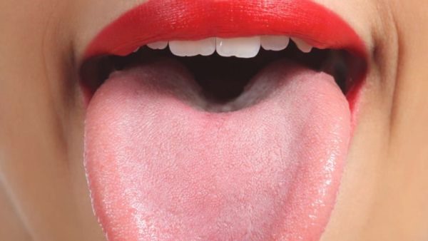 Lưỡi trắng có phải là căn bệnh đáng lo ngại?-1