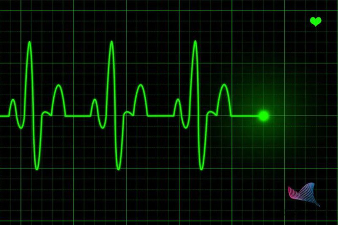 Nhịp tim nhanh hay chậm ảnh hưởng thế nào đến tuổi thọ? Bác sĩ lý giải nhịp tim bao nhiêu là tốt nhất!-3