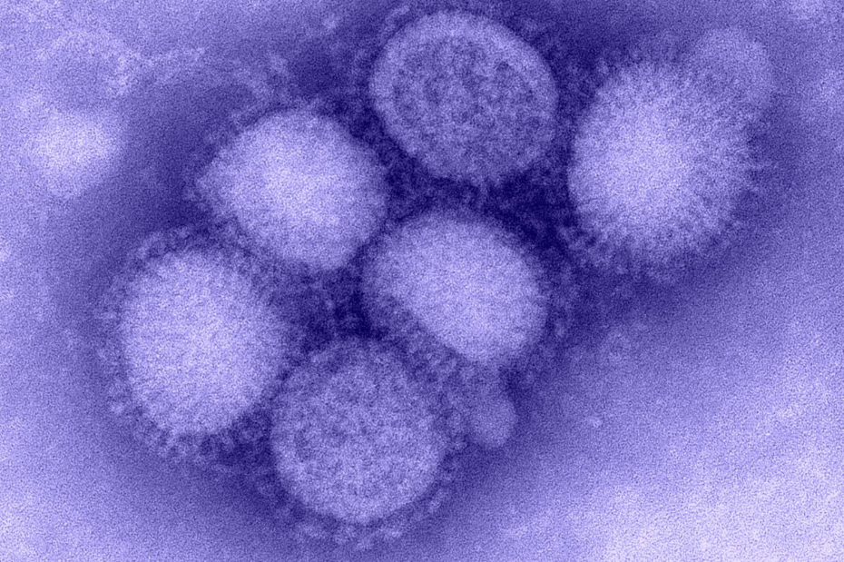 6 nhóm người có nguy cơ chuyển nặng khi mắc cúm-1