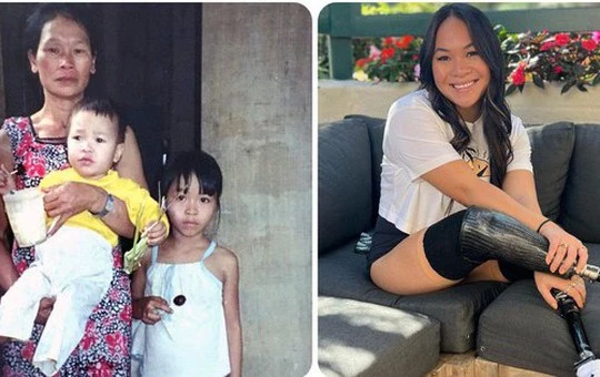 Cuộc sống hiện tại của bé gái gốc Việt bị bố mẹ nổ bom mất 2 chân: Được báo chí thế giới gọi là 'nữ kình ngư thần kỳ', trở thành đại sứ truyền cảm hứng cho những người khuyết tật-cover-img
