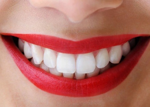Không phải răng trắng tinh là tốt cho sức khỏe-2