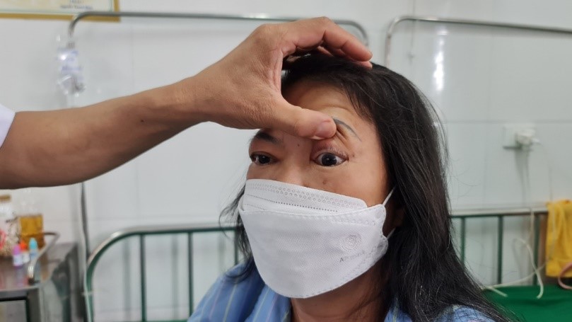 Bệnh viện Nội tiết Nghệ An điều trị hiệu quả bệnh lồi mắt sau Basedow-5