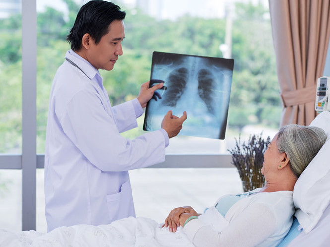 Viêm phổi mắc phải cộng đồng: Dấu hiệu nhận biết và cách phòng ngừa-3