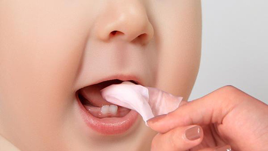 Nấm lưỡi, miệng ở trẻ: xử trí và phòng ngừa thế nào?-1