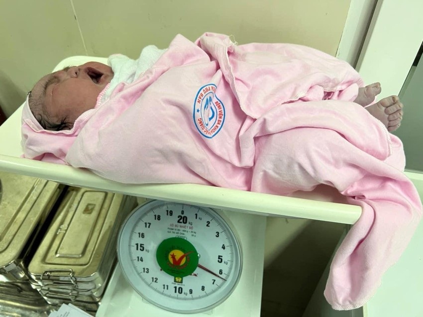 Bắc Giang: Bé gái vừa chào đời với cân nặng 6,2 kg khiến các bác sĩ bất ngờ-1