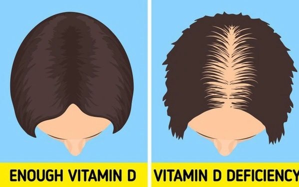 6 dấu hiệu cảnh báo cơ thể thiếu vitamin D, cần làm ngay 5 việc để bổ sung-1