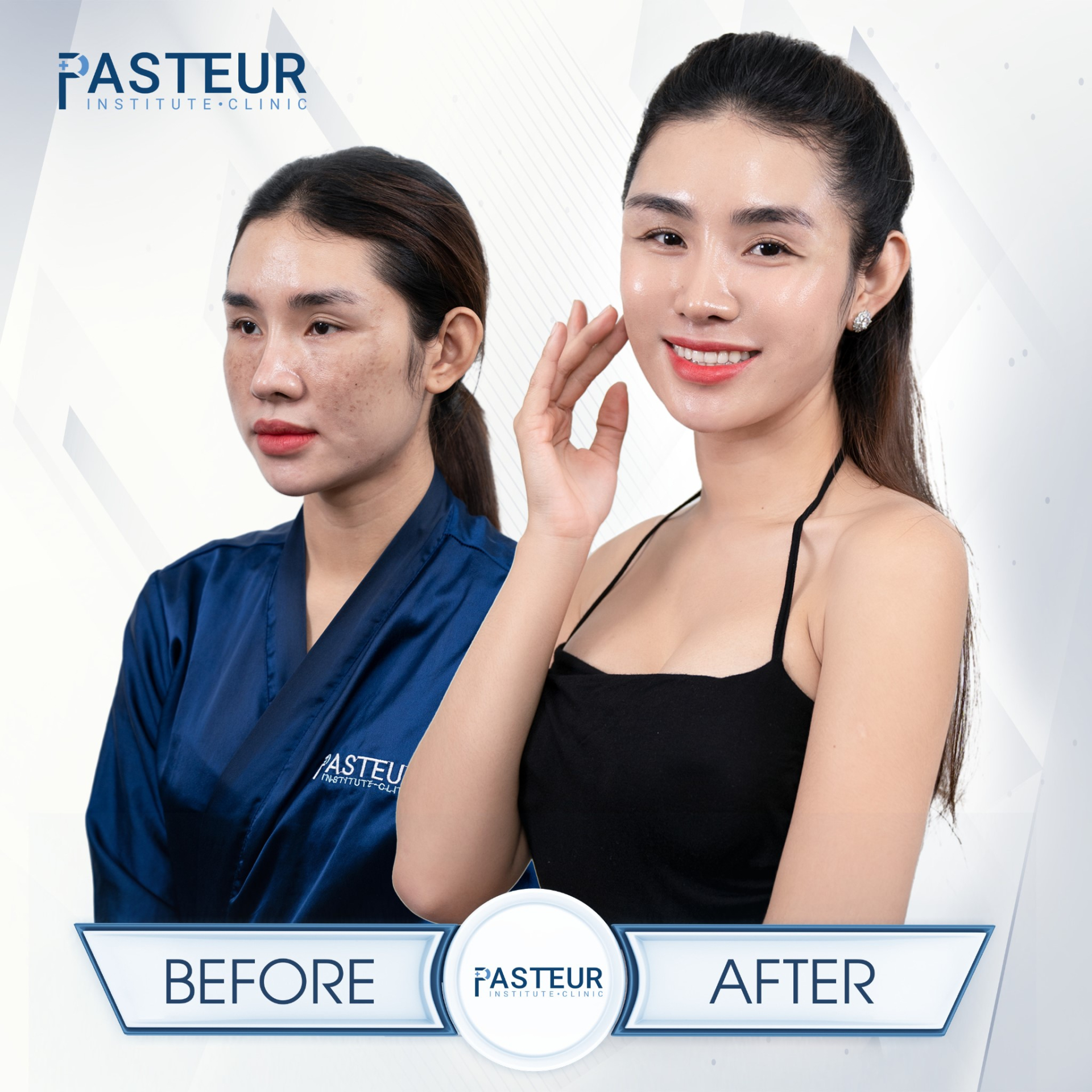 Pasteur Clinic - Phòng khám thẩm mỹ tân trang nhan sắc phụ nữ Việt-1