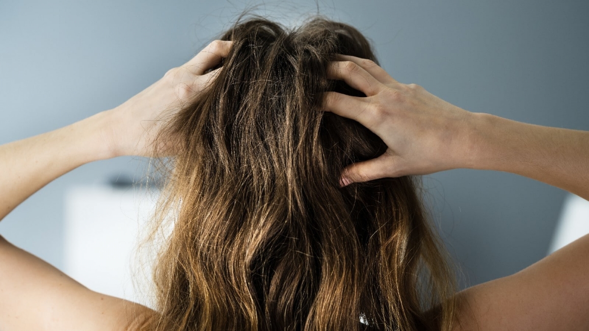 8 cách "giải cứu" bạn khỏi rụng tóc-1