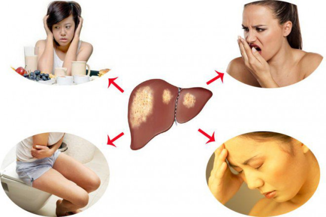 6 dấu hiệu cơ thể cảnh báo gan của bạn đang nhiễm độc, cần dừng ngay những thói quen này và thải độc cho gan-1