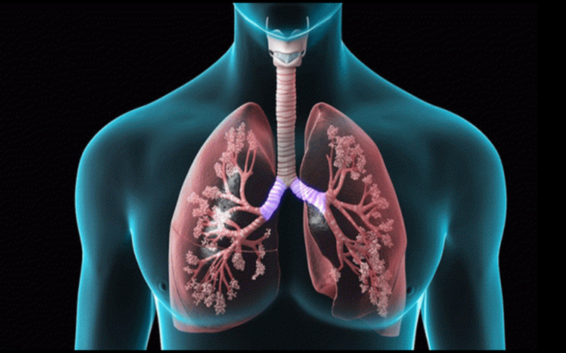 Xơ phổi hậu COVID-19: Chuyên gia chỉ cách điều trị-3