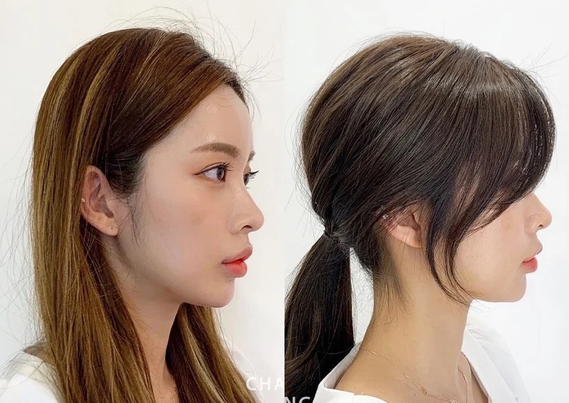 Han So Hee lộ cả mảng đầu hói chỉ vì chọn sai kiểu tóc-5