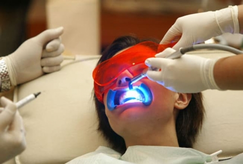 Điều gì khiến răng của bạn ngày càng trở nên vô cùng nhạy cảm-3