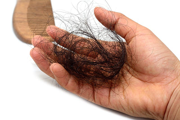 "Mùa rụng tóc" phải làm thế nào để tránh tóc rụng lả tả, xác xơ-1