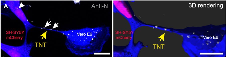 Hé lộ con đường virus SARS-CoV-2 xâm nhập vào các tế bào thần kinh-2