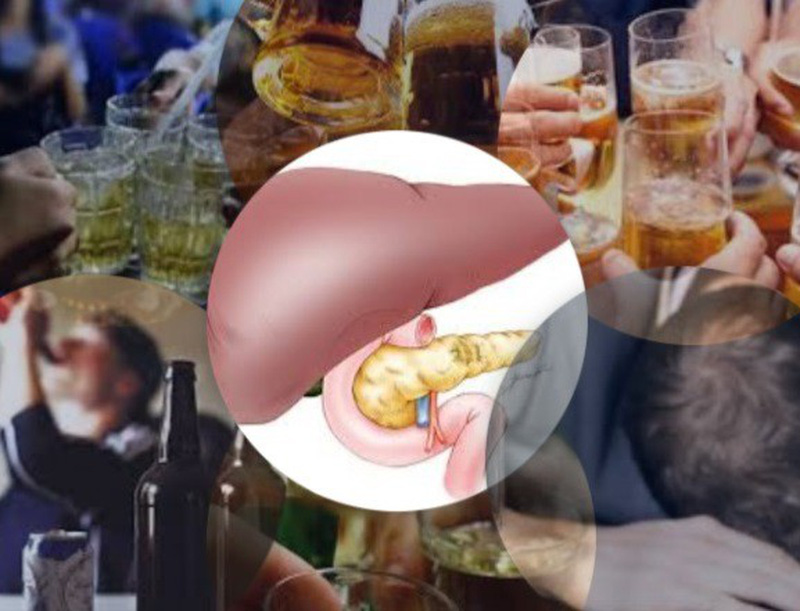 Viêm tụy mạn tính: Ngoài bia rượu còn có yếu tố nào gây bệnh và dấu hiệu nhận biết-1