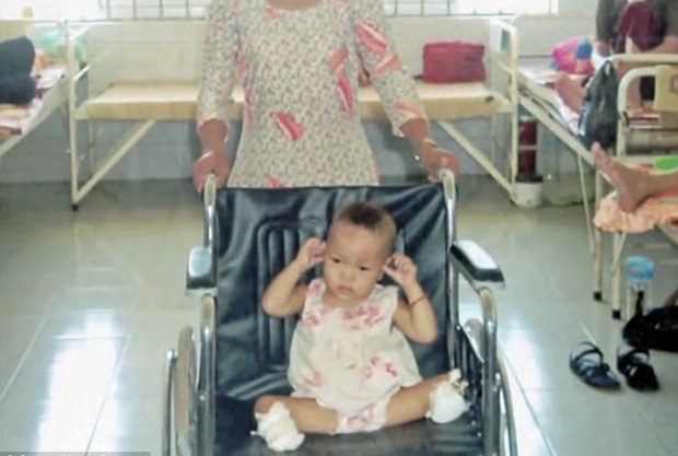 Cuộc sống hiện tại của bé gái gốc Việt bị bố mẹ nổ bom mất 2 chân: Được báo chí thế giới gọi là 'nữ kình ngư thần kỳ', trở thành đại sứ truyền cảm hứng cho những người khuyết tật-3