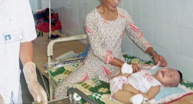 Cuộc sống hiện tại của bé gái gốc Việt bị bố mẹ nổ bom mất 2 chân: Được báo chí thế giới gọi là 'nữ kình ngư thần kỳ', trở thành đại sứ truyền cảm hứng cho những người khuyết tật-2