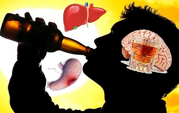 Chuyên gia cảnh báo nguy hại khi giới trẻ sử dụng rượu, bia-1