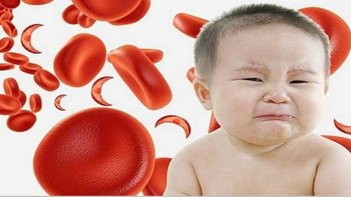 Dấu hiệu thiếu máu ở trẻ và cách khắc phục-2