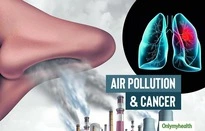 Ô nhiễm không khí dẫn đến ung thư phổi ra sao?-cover-img