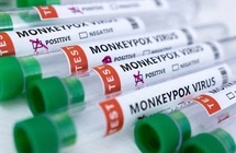 Những dấu hiệu chỉ điểm ca bệnh liên quan đậu mùa khỉ-cover-img