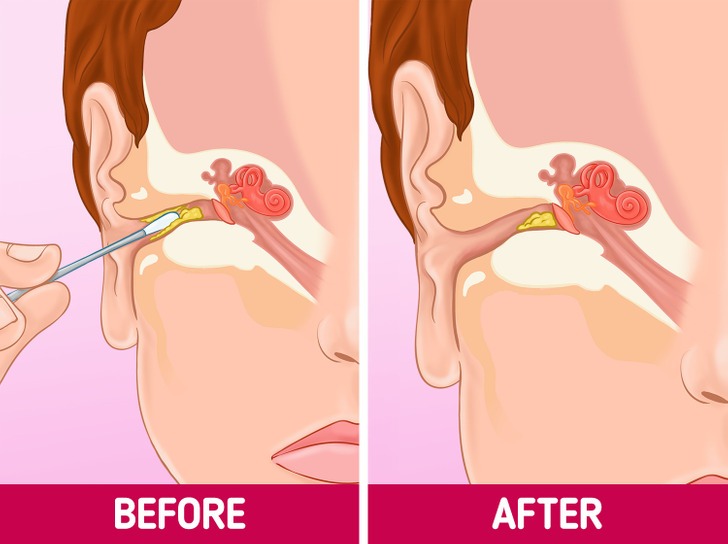 Đây là những lý do mà bạn nên ngừng ngay việc dùng tăm bông để vệ sinh tai và nhưng phương pháp khác để thay thế cho việc này-2