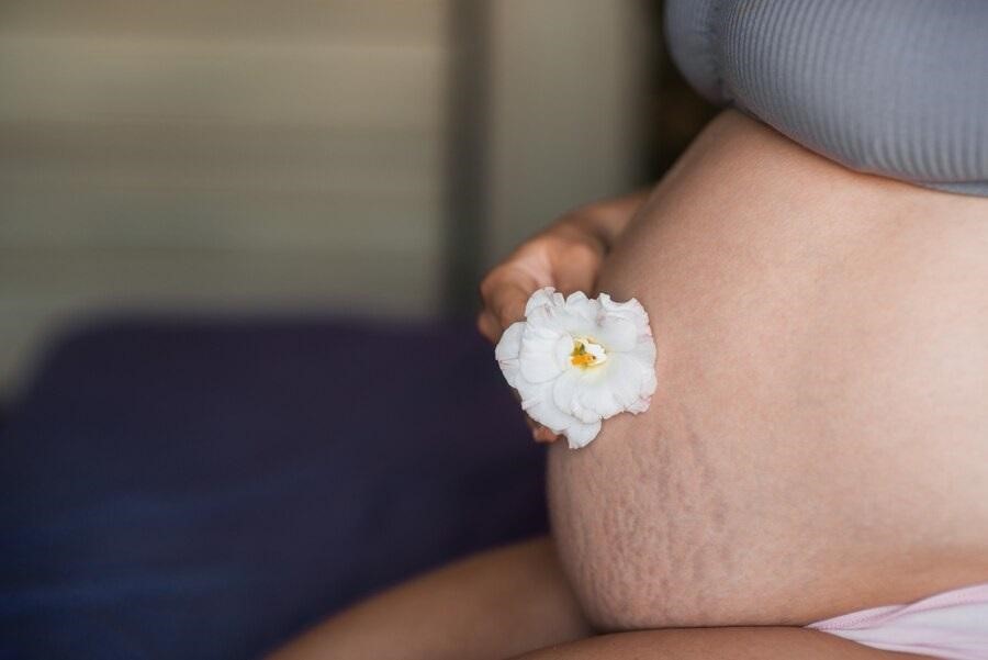 Ngăn ngừa rạn da khi mang thai thế nào cho an toàn, hiệu quả?-1